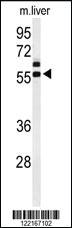 Anti-AMH Rabbit Polyclonal Antibody