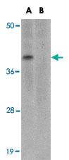 Anti-MC4R Rabbit Polyclonal Antibody