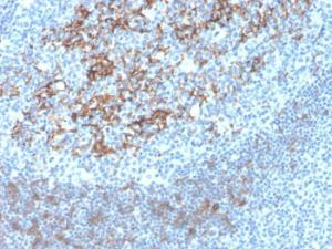 Immunohistochemical analysis of formalin-fixed, paraffin-embedded human tonsil using Anti-CD23 Antibody [FCER2/4395R]