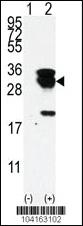 Anti-E2EPF Rabbit Polyclonal Antibody