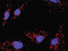 Anti-AKT1 + FOXO1 Antibody Pair