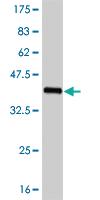 Anti-FOXC2 Mouse Monoclonal Antibody [clone: 4A5]