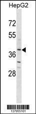 Anti-OR2K2 Rabbit Polyclonal Antibody (AP (Alkaline Phosphatase))