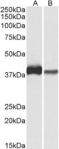 Anti-CAPG Antibody (A82704) (0.3µg/ml) staining of U937 (A) and Human Spleen (B) lysates (35µg protein in RIPA buffer). Primary incubation was 1 hour. Detected by chemiluminescence.