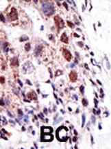 Anti-E2EPF Rabbit Polyclonal Antibody