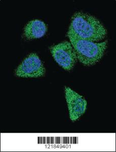 Anti-C6 Rabbit Polyclonal Antibody