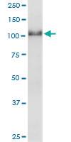 Anti-RFX6 Polyclonal Antibody Pair