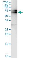 Anti-BTBD9 Polyclonal Antibody Pair