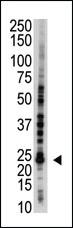 Anti-E2EPF Rabbit Polyclonal Antibody