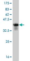 Anti-FOXC2 Mouse Monoclonal Antibody [clone: 4A3]