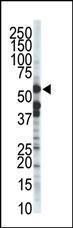 Anti-ZMPSTE24 Rabbit Polyclonal Antibody (AP (Alkaline Phosphatase))