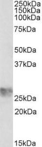 Anti-ICAM4 Antibody (A82705) (1 µg/ml) staining of Human Umbillical Cord lysate (35 µg protein in RIPA buffer). Primary incubation was 1 hour. Detected by chemiluminescence