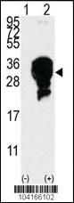 Anti-E2EPF Rabbit Polyclonal Antibody