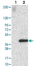 Anti-FAM212B Rabbit Polyclonal Antibody