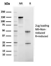 SDS-PAGE analysis of Anti-BAP1 Antibody [BAP1/2665] under non-reduced and reduced conditions; showing intact IgG and intact heavy and light chains, respectively. SDS-PAGE analysis confirms the integrity and purity of the antibody