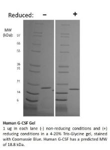 Human Recombinant G-CSF (from <i>E. coli</i>)