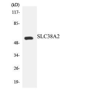 Western blot analysis of the lysates from HeLa cells using Anti-SLC38A2 Antibody