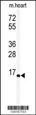 Anti-UBE2G1 Rabbit Polyclonal Antibody