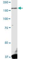 Anti-LRRK1 Rabbit Polyclonal Antibody