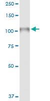 Anti-NLGN4X Polyclonal Antibody Pair