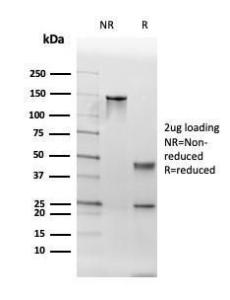 Anti-Thyroid Peroxidase antibody