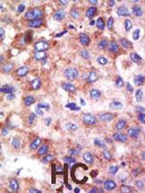 Anti-UBE2G1 Rabbit Polyclonal Antibody