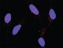 Anti-AKT1 + MDM2 Antibody Pair