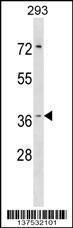 Anti-HYI Rabbit Polyclonal Antibody (PE (Phycoerythrin))