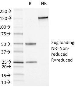 SDS-PAGE analysis of Anti-CD13 Antibody [APN/1464] under non-reduced and reduced conditions; showing intact IgG and intact heavy and light chains, respectively. SDS-PAGE analysis confirms the integrity and purity of the antibody