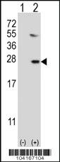 Anti-UBE2G1 Rabbit Polyclonal Antibody