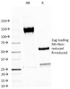 SDS-PAGE analysis of Anti-MUC1 Antibody [MUC1/520] under non-reduced and reduced conditions; showing intact IgG and intact heavy and light chains, respectively. SDS-PAGE analysis confirms the integrity and purity of the antibody.