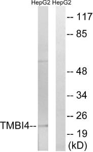 Western blot analysis of lysates from HepG2 cells using Anti-TMBIM4 Antibody. The right hand lane represents a negative control, where the Antibody is blocked by the immunising peptide