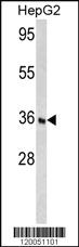 Anti-FOSB Rabbit Polyclonal Antibody