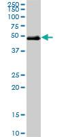 Anti-HNF1B Mouse Monoclonal Antibody [clone: 3H4]