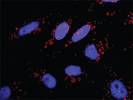 Anti-APPL1 + PIK3CA Antibody Pair