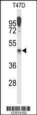 Anti-LAMP2 Rabbit Polyclonal Antibody (HRP (Horseradish Peroxidase))