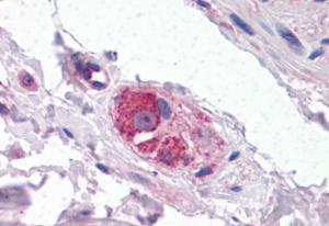 Anti-CYP26B1 Antibody (A84266) (3.75 µg/ml) staining of paraffin embedded Human Small Intestine. Steamed antigen retrieval with citrate buffer pH 6, AP-staining