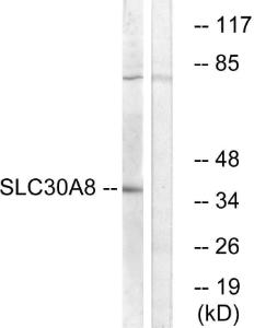 Western blot analysis of lysates from K562 cells using Anti-SLC30A8 Antibody. The right hand lane represents a negative control, where the antibody is blocked by the immunising peptide