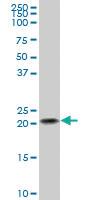 Anti-NDUFB10 Mouse Polyclonal Antibody