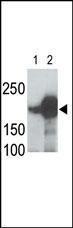 Anti-LRP5 Rabbit Polyclonal Antibody (APC (Allophycocyanin))