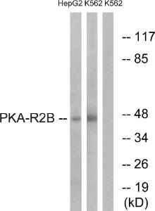 Western blot analysis of lysates from K562 and HepG2 cells using Anti-PKA-R2 beta Antibody The right hand lane represents a negative control, where the antibody is blocked by the immunising peptide