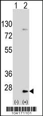 Anti-UBE2H Rabbit Polyclonal Antibody