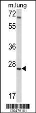 Anti-IGFBP4 Rabbit Polyclonal Antibody