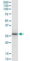 Anti-LRRK1 Rabbit Polyclonal Antibody