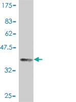 Anti-PRDM2 Mouse Polyclonal Antibody