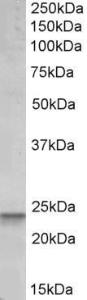 Anti-BBC3 Antibody (A82709) (0.1 µg/ml) staining of Peripheral Blood Lymphocytes lysate (35 µg protein in RIPA buffer). Primary incubation was 1 hour. Detected by chemilu minescence