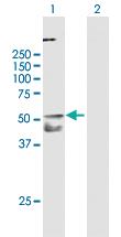 Anti-TNFRSF10A Mouse Polyclonal Antibody