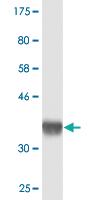 Anti-SETDB2 Mouse Monoclonal Antibody [clone: 2F4]