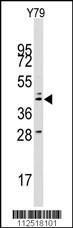 Anti-LAMP2 Rabbit Polyclonal Antibody (AP (Alkaline Phosphatase))