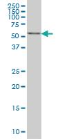 Anti-ADCK3 Mouse Monoclonal Antibody [clone: 8F7]